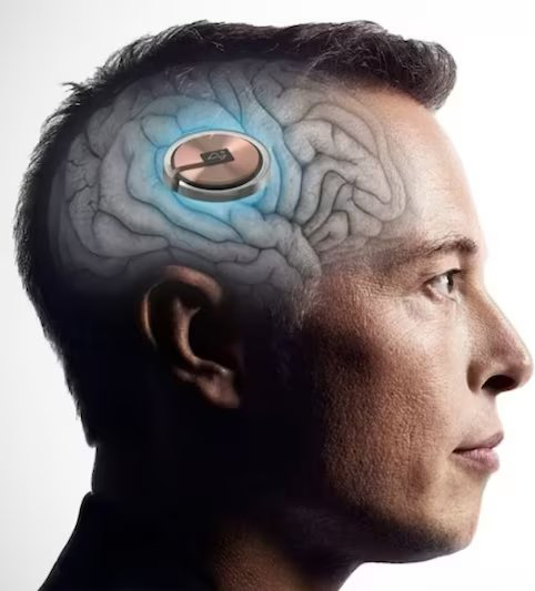 Elon Musk with the chip implanted