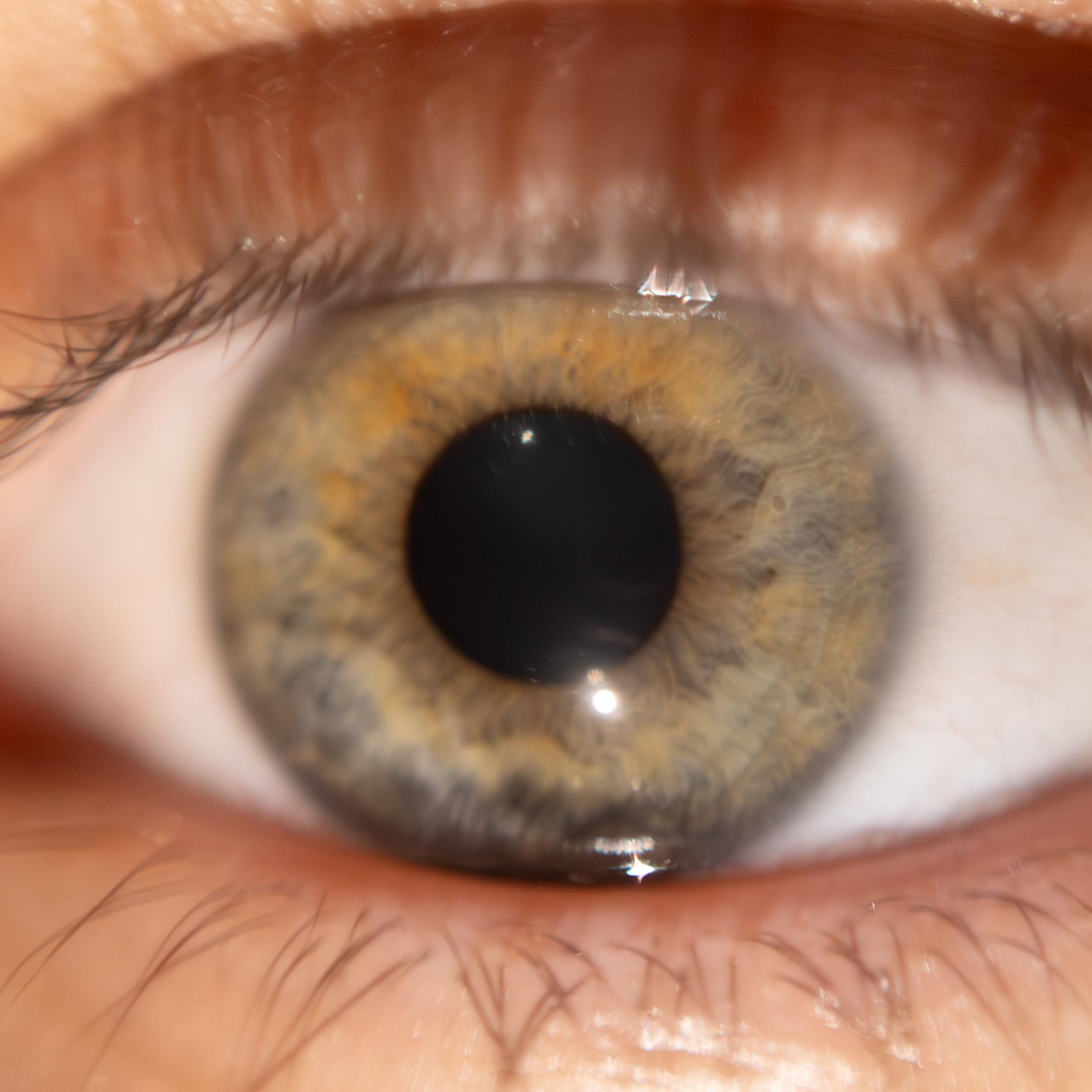 Fisher's eye